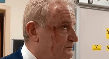 Gazeteci Hakkı Sağlam’a darp soruşturmasında 2 tutuklama