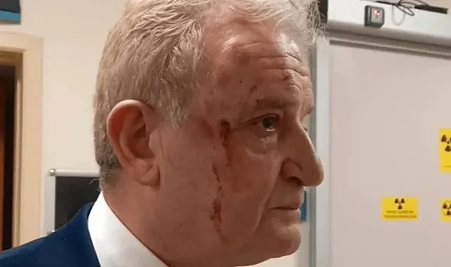 Gazeteci Hakkı Sağlam’a darp soruşturmasında 2 tutuklama